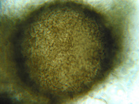 Microascus cinereus