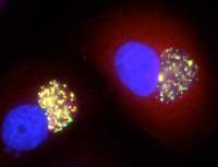 Cellules infectées par Chlamydia caviae