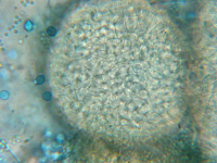 Neosartorya fischeri