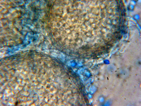 Neosartorya fischeri