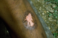 Lésion cicatrisée d'une leishmaniose cutanée
