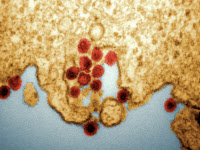Cellule humaine infectée par le virus Chikungunya