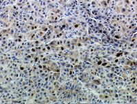Expression de la beta-caténine dans les hépatocytes humains primaires