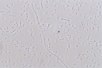 Clostridium innocuum