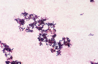 Actinomyces nasicola