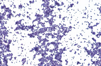 Staphylococcus aureus, staphylocoque doré
