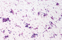 Streptococcus minor