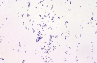 Mycobacterium aubagnense