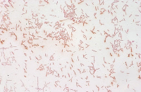 Legionella brunensis