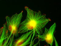 Cellules de gliome non polarisées