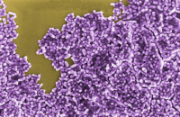 Mycobacterium fortuitum en microscopie electronique à balayage. Fausses couleurs.
