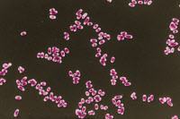 Mycobacterium avium en microscopie electronique à balayage. Fausses couleurs.