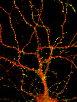 Microscopie d'un neurone. Le marquage jaune montre les synapses.