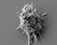 Cellule dendritique observée en microscopie électronique à balayage
