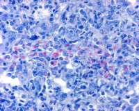 Tissu pulmonaire de souris infecté par Mycobacterium tuberculosis (en rose).