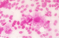 Bactériémie expérimentale à Neisseria meningitidis chez la souris.