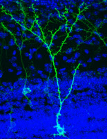Néo-neurone de souris observée en microscopie à fluorescence