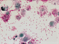 Bactéries Rickettsia conorii. Coloration de Gimenez
