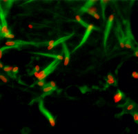 Comètes d'actine des bactéries Rickettsia conorii dans des cellules Vero infectées