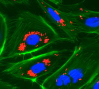 Cellules PtK2 infectées par des bactéries mutantes de <i>Listeria monocytogenes</i>.