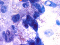 Bactéries Rickettsia conorii. Coloration de Gimenez
