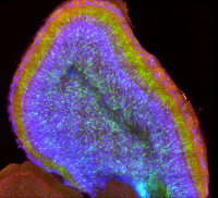 Coupe de cerveau de souris observée en microscopie à fluorescence.