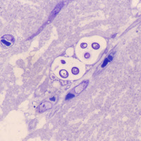 Méningoencéphalite cryptococcique chez la souris