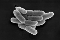 Yersinia pestis, bacille de la peste en microscopie electronique à balayage.