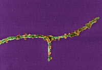 Vue en microscopie électronique à balayage de particules du virus Chikungunya bourgeonnant à la surface d'un fibroblaste infecté en culture.