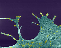 Vue en microscopie électronique à balayage de particules du virus Chikungunya bourgeonnant à la surface d'un fibroblaste infecté en culture.
