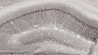 Dégénérescences neurofibrillaires chez la souris transgénique