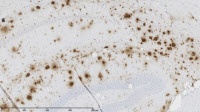 Plaques amyloïdes de souris transgénique