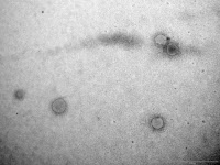 Particules virales de Coronavirus MERS-CoV en microscopie électronique.