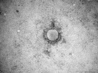Particule virale de Coronavirus MERS-CoV en microscopie électronique.