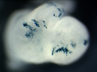 Cœur d'un embryon de souris
