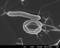 Helicobacter pylori et artefact