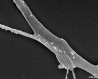 Cellules d'insectes infectées par le virus du chikungunya
