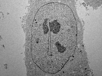 Cellule HeLa infectée par le virus du chikungunya - "Statue Moai"