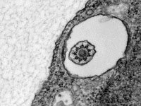 Coupe transversale d'un flagelle de trypanosome