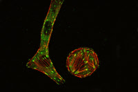 Modifications morphologiques des cellules Vero induites par la toxine létale de Clostridium sordellii - « Vero cells playing football »