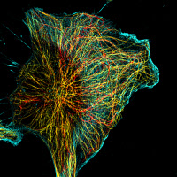 Cytosquelette d'un gliome en migration