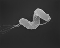 Bactérie Helicobacter pylori en microscopie électronique à balayage. 