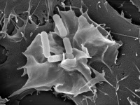 Cellule épithéliale envahie par des bactéries du genre Shigella (microscopie électronique).