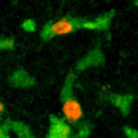 Capture de lymphocytes B cancéreux (en orange) dans le foie par des cellules de Kupffer (en vert).