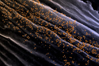 Vue en microscopie électronique à balayage de particules du virus Chikungunya à la surface d'un fibroblaste infecté en culture.