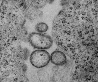 Virus vaccinal chimérique rougeole-SIV en microscopie électronique.