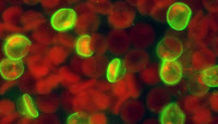 Révélation par immunofluorescence de la présence de la protéine Pf155/RESA  dans les globules rouges infectés par Plasmodium falciparum.