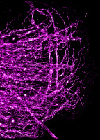 Cytosquelette de vimentine d'un gliome (lignée U373) cultivé in vitro et observé par microscopie de super-résolution STORM