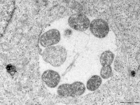 Cellule épitheliale infectée par Chlamydia trachomatis.