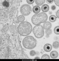 Cellule épitheliale infectée par Chlamydia trachomatis